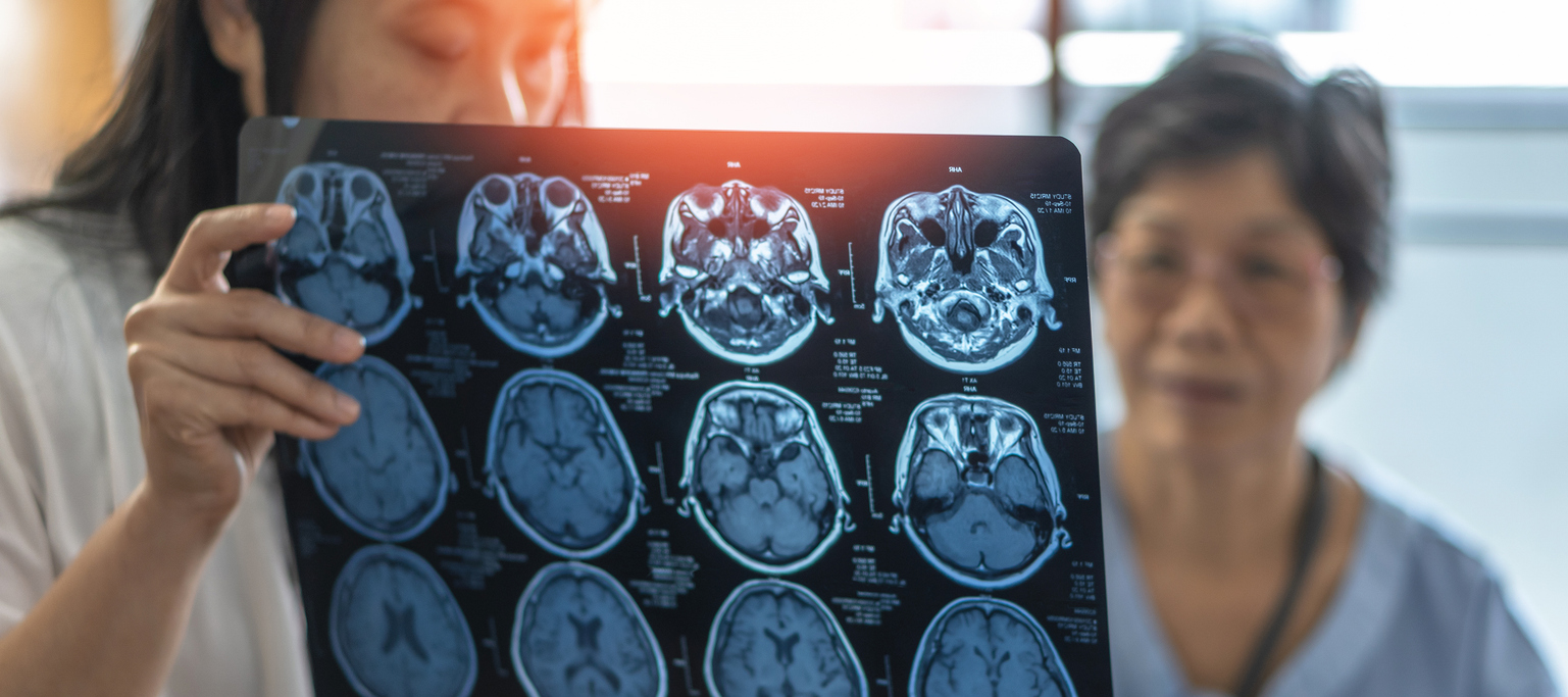 Magnetic Resonance Imaging (MRI) film for Brain disease diagnosis with medical doctor diagnosing an older patient neurodegenerative illness problem seeing for neurological medical treatment